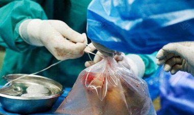 مرگ روزانه ۷ تا ۱۰ نفر به علت نرسیدن عضو پیوندی