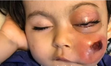 ببینید|این بلا را مرغ مینا بر سر کودک آورده است