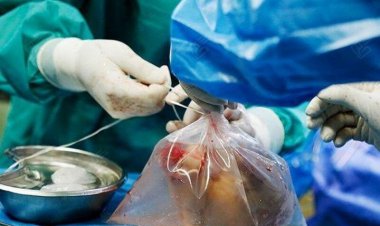 مردی که با مرگش به سه بیمار جان بخشید