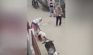 لحظه حمله سگ به کودک در مقابل صاحبش