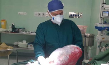 خارج کردن غده 8 کیلویی از شکم یک کودک