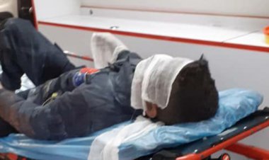 دومین حادثه انفجار ترقه نوجوان ۱۳ ساله را راهی بیمارستان کرد