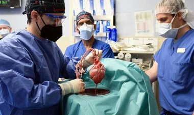 فوت نخستین گیرنده قلب خوک