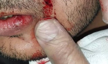 وزیر بهداشت از پزشک مضروب گچسارانی دلجویی کرد