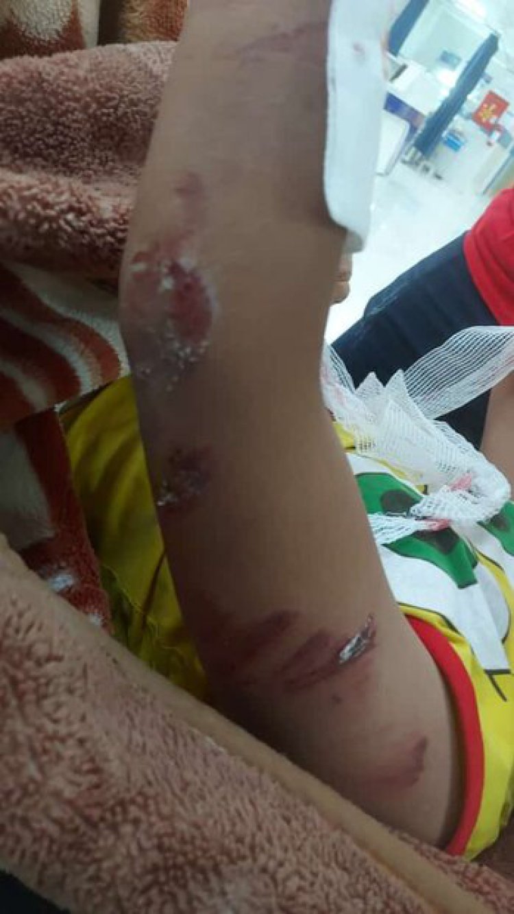 حمله سگ‌های ولگرد به پسر۱۲ ساله در حاجی آباد