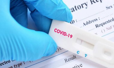 طراحی کیت بزاقی تشخیص کرونا در کشور