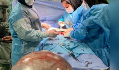 خارج کردن توده‌ ۱۴ کیلویی از شکم بیمار اهوازی