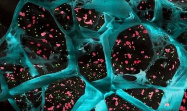 هیدروژلی که می‌تواند از پیشروی سرطان جلوگیری کند