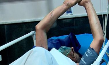 نجات سه بیمار با سوختگی بالای ۷۰ درصد در شیراز