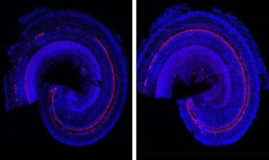 داروی احیا کننده جدید دانشمندان برای کم‌شنوایی