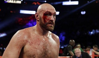 زندگی وحشی تایسون فیوری ؛ قهرمانی که ۵۰ کیلو وزن کم کرد