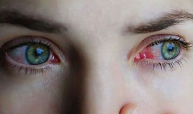 راهحل چینیها برای جلوگیری از نابینایی