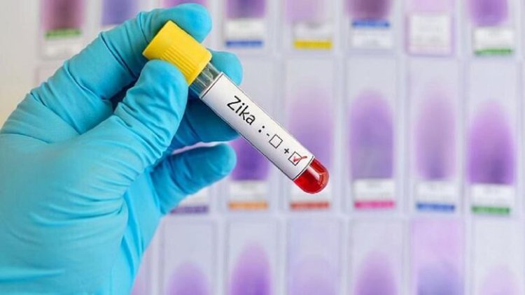 هشدار دانشمندان: مراقب ویروس زیکا باشید!