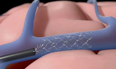 پیدا شدن یک رقیب برای تراشه مغزی "ایلان ماسک"!