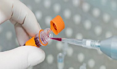تولید کیت شناسایی ویروس از سوی شرکتهای دانشبنیان ایرانی
