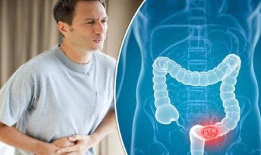 مصرف بیش از حد نوشابه های شیرین باعث سرطان روده می شود