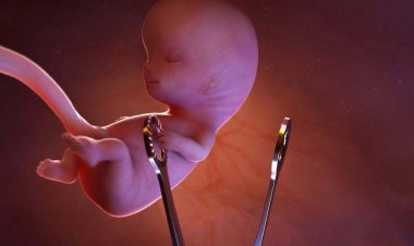 سقط غیرقانونی سالانه ۳۷۰ هزار جنین در کشور