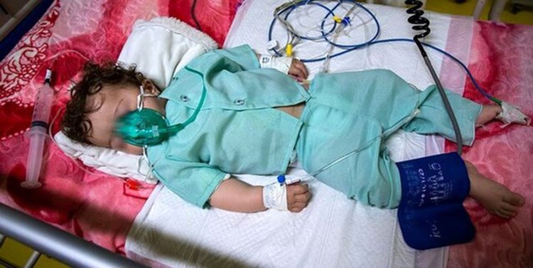 ۵۰ درصد بخش ویژه بیماران کرونایی بیمارستان کودکان ابوذر اهواز تکمیل شد