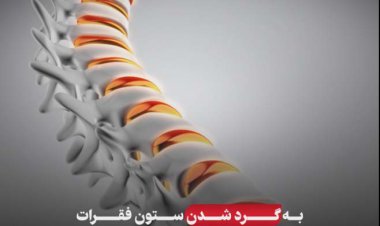 آنچه باید در مورد « قوز» بدانیم
