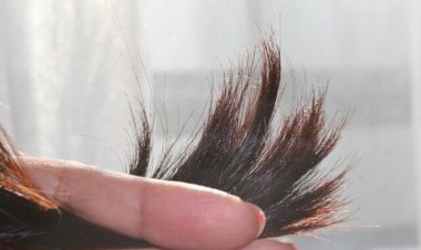 تاثیر یک ژل گیاهی در کاهش "موخوره"