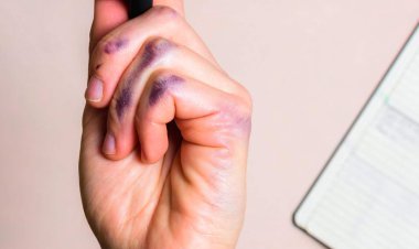 نگاهی راست به زندگی چپ دست‌ها