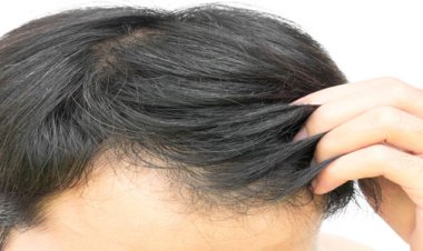 موهایتان نشان می‌دهد چقدر استرس دارید    