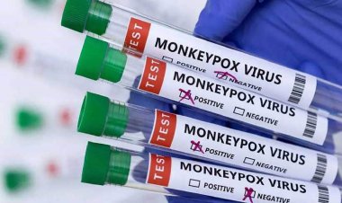 فعلا نیازی به واکسیناسیون آبله میمون نیست