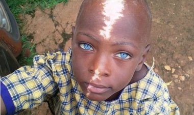 چهره این کودک شهرت جهانی دارد