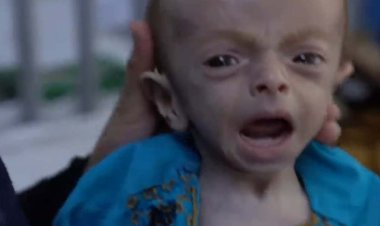 زندگی در حکومت طالبان؛ مرتضی ۴ماهه فقط ۱۸۰۰گرم وزن دارد!   