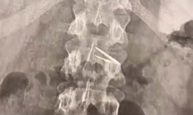 ببینید | کشف شیشه و تیغه فلزی در کیک!