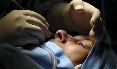 یک دختر نوجوان قربانی جراحی زیبایی شد!