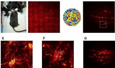مشاهده درون جمجمه با میکروسکوپ جدید