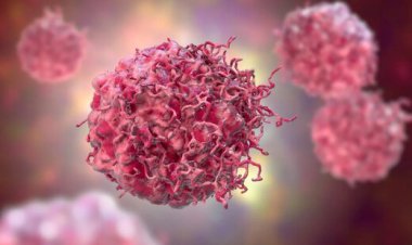 زنده ماندن معجزه آمیز این زن با ۱۲ تومور!+ عکس