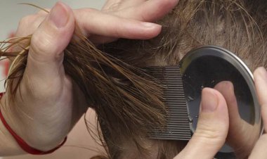 استفاده از سموم برای درمان شپش ممنوع