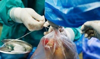 اهدای عضو در استان بوشهر جان سه بیمار نیازمند را نجات داد    