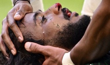 جمجمه شهرانی خرد شد!