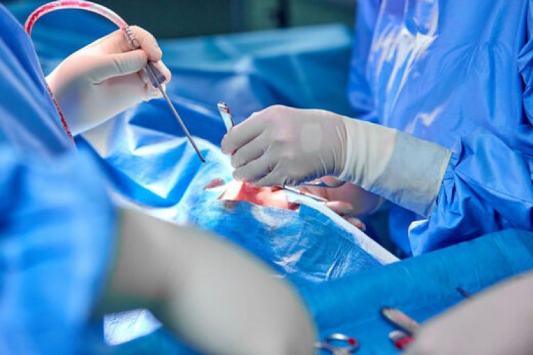 بیمارستان کنگان رکورد زد/ انجام ۲۱ عمل جراحی طی یک روز