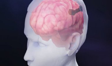 امکان استفاده از شبکه‌های اجتماعی با استفاده از ذهن برای بیماران فلج اندام