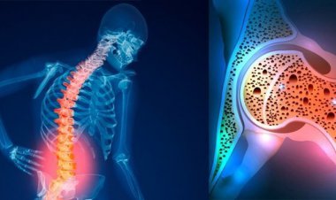 ویدئو| چه کنیم که پوکی استخوان نگیریم؟