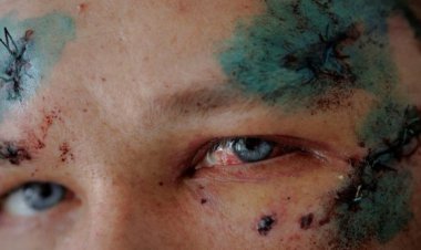 تصاویر| یک سالگی جنگ در اوکراین