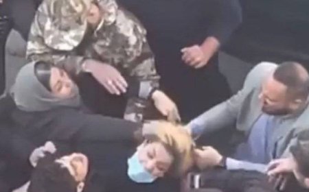 تصاویر دلخراش حمله به یک شهروند خانم خبرساز شد
