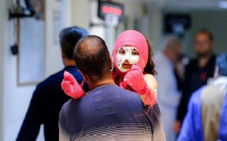 آماری عجیب از مصدومیت رهگذران در حوادث چهارشنبه‌سوری