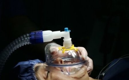 هذیان بعد از جراحی می تواند نشانه زوال ذهنی سریع تر باشد