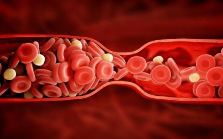 شناسایی علت مشترک ام اس و بیماری قلبی