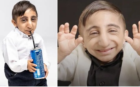 عکس|جوان ایرانی با کوچکترین دستهای دنیا رکورد زد