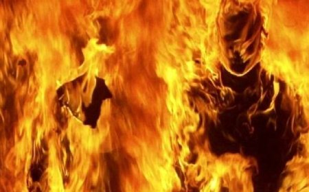 پسر عاشق‌پیشه خودش را آتش زد