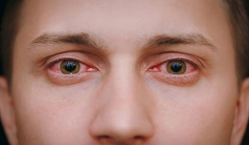 این قطره چشمی منجر به مرگ و نابینایی بیماران شد