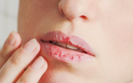 علت اصلی خشکی دهان چیست؟