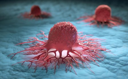 علائم زودهنگام دومین سرطان مرگبار جهان