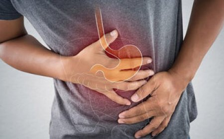 با این خوراکیها از ترش کردن معده جلوگیری کنید